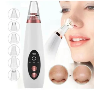 Blackhead Remover
